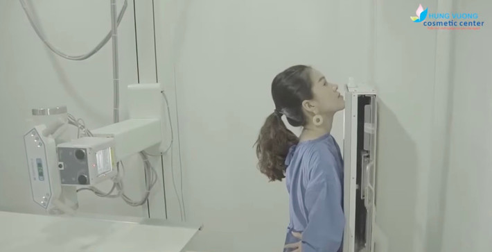 Có thể thấy, cô nàng đã sở hữu những đường nét thanh tú, tuy nhiên có khuyết điểm là hàm móm. Sau khi thực hiện phẫu thuật, gương mặt của nữ diễn viên thanh thoát hơn, ưa nhìn hơn.