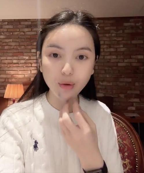 Chu Thanh Huyền cũng kể lại trải nghiệm kinh hoàng của mình khi tiêm filler vào cằm nhưng đã đi tiêm tan 6 lần nhưng không được. Bà xã Quang Hải cũng khẳng định bản thân cô nàng bây giờ sẽ không tiêm thêm thứ gì mà chỉ có tiêm để tan những filler cũ.