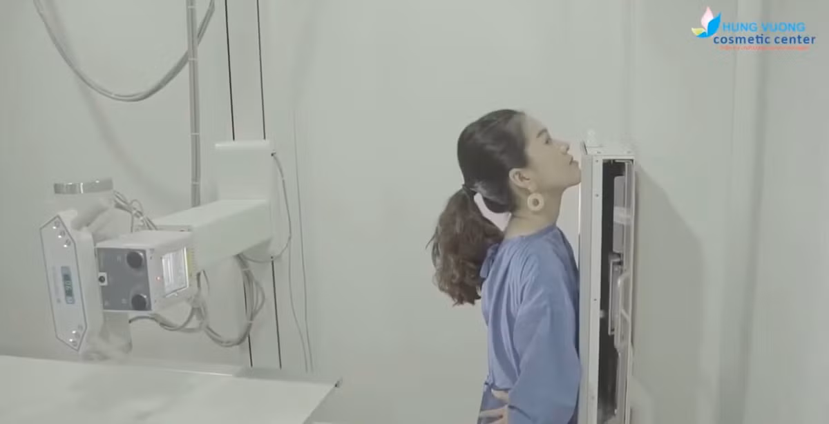 Có thể thấy, cô nàng đã sở hữu những đường nét thanh tú, tuy nhiên có khuyết điểm là hàm móm. Sau khi thực hiện phẫu thuật, gương mặt của nữ diễn viên thanh thoát hơn, ưa nhìn hơn.