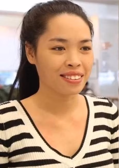 Nhờ chương trình, Vũ Thanh Quỳnh đã nhận được suất tài trợ phẫu thuật thẩm mỹ toàn diện tại Hàn Quốc. Cô trải qua một quá trình đau đớn và kiên nhẫn với nhiều ca phẫu thuật phức tạp như: cắt xương hàm, chỉnh hô, gọt cằm, nhấn mí mắt và nâng mũi.