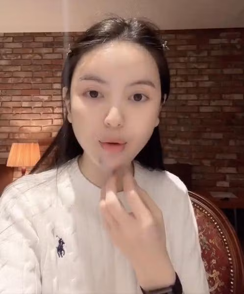 Chu Thanh Huyền cũng kể lại trải nghiệm kinh hoàng của mình khi tiêm filler vào cằm nhưng đã đi tiêm tan 6 lần nhưng không được. Bà xã Quang Hải cũng khẳng định bản thân cô nàng bây giờ sẽ không tiêm thêm thứ gì mà chỉ có tiêm để tan những filler cũ.