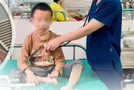 Trẻ 8 tuổi ở Nghệ An nguy kịch vì uống nhầm bột thông cống