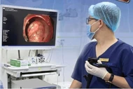 Phát hiện u thần kinh nội tiết trực tràng nhờ nội soi 