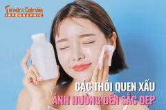[INFOGRAPHIC] Các thói quen xấu ảnh hưởng đến sắc đẹp