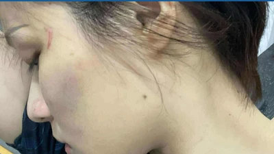 Danh tính cô gái MMA "hạ gục" thanh niên xăm trổ ở hầm giữ xe