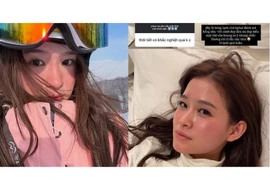 Đi săn tuyết ở Cáp Nhĩ Tân, nữ du khách bất ngờ bị bỏng lạnh giữa trời âm sâu