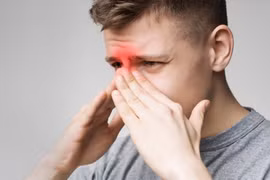 Nghẹt mũi, đau họng đi khám phát hiện... u hốc mũi trái