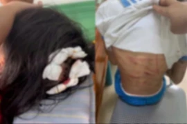 Lời khai man rợ của gã cha dượng bạo hành bé gái ở Hà Tĩnh