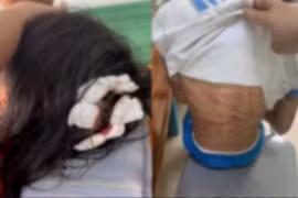 Lời khai man rợ của gã cha dượng bạo hành bé gái ở Hà Tĩnh