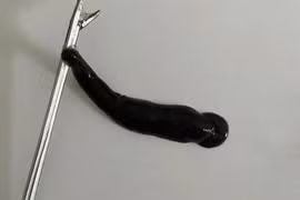 Gắp ra con đỉa sống ký sinh trong mũi bệnh nhi ở Quảng Trị