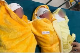 Mổ đẻ thành công ca sinh 3 tự nhiên hiếm gặp ở Quảng Trị