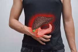 Làm sao để giữ gan khỏe khi nam giới thường xuyên uống rượu bia?