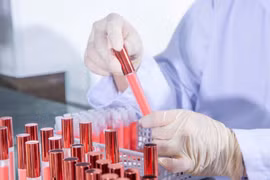 "Điểm tên" hoá chất độc hại thường gặp trong mỹ phẩm
