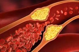 Cách ăn uống đánh bay mỡ nội tạng sau tuổi 40