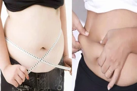 Mối hiểm họa từ mỡ nội tạng ở người trẻ