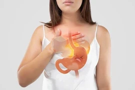 Căn bệnh phổ biến có thể âm thầm dẫn đến ung thư thực quản