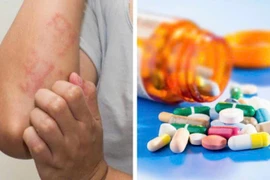 Dị ứng kháng sinh, tai biến y khoa ai cũng có thể gặp