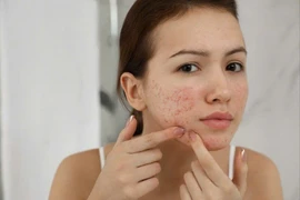 Tổn thương da vì dùng mỹ phẩm không đúng hướng dẫn