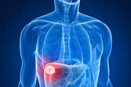 Bảo vệ gan mỗi ngày từ những thay đổi nhỏ trong bữa ăn