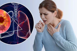 Ung thư phổi không do hút thuốc, cảnh báo mối nguy mới