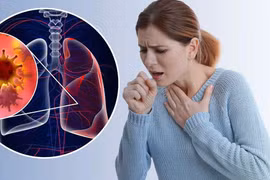 Ung thư phổi không do hút thuốc, cảnh báo mối nguy mới