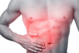 Nguy cơ viêm gan vì dùng thuốc Nam không rõ nguồn gốc