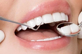 Tiền mất tật mang vì răng sứ giá rẻ