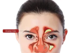 Phòng viêm xoang tái phát từ những thói quen hằng ngày