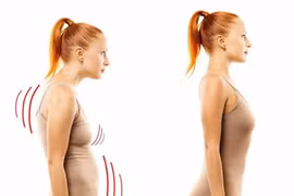 Tư thế sai khi dùng điện thoại, nguy cơ cổ rùa