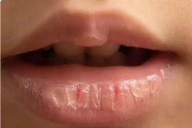 Vì sao dưỡng môi nhiều vẫn không hiệu quả?