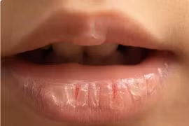 Vì sao dưỡng môi nhiều vẫn không hiệu quả?