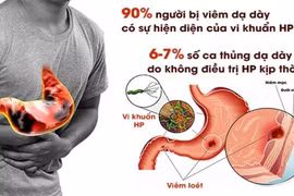 Sự thật ít biết về vi khuẩn HP