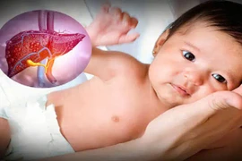 Phòng ngừa, phát hiện sớm viêm gan lạ ở trẻ nhỏ