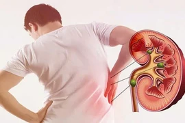 Ăn nhiều thực phẩm giàu đạm, muối ảnh hưởng đến thận ra sao?