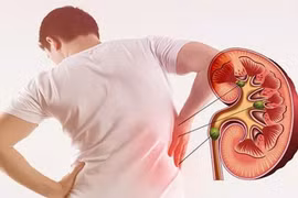 Ăn nhiều thực phẩm giàu đạm, muối ảnh hưởng đến thận ra sao?