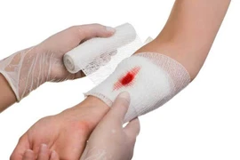 Kỹ năng sơ cứu ai cũng cần khi tai nạn xảy ra