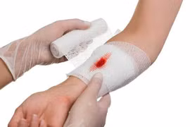 Kỹ năng sơ cứu ai cũng cần khi tai nạn xảy ra