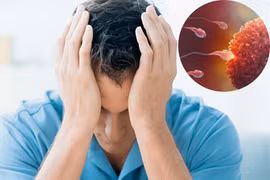 Hiểm họa vô sinh từ thói quen sinh hoạt ở nam giới