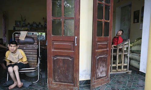 Ảnh nhói lòng nạn nhân chất độc da cam trên báo Tây