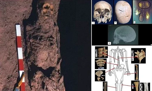Phát hiện 6 bộ hài cốt mắc bệnh ung thư tại Ai Cập