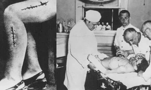 Rùng mình thí nghiệm trên cơ thể người của Đức quốc xã