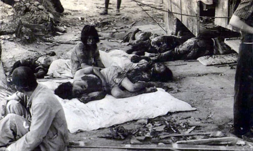 Đau lòng ảnh nạn nhân vụ Mỹ thả bom nguyên tử xuống Nhật