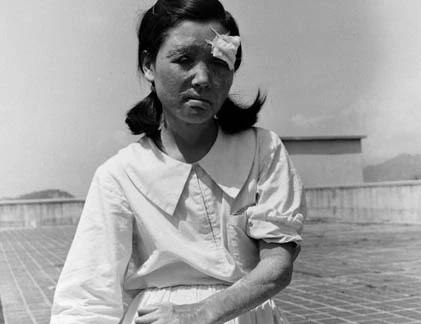 Ảnh hiếm: Nỗi đau của Hiroshima sau thảm họa hạt nhân