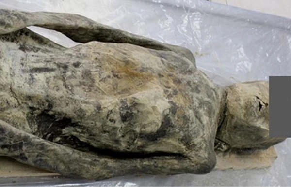 Xem xác ướp thế kỷ 17 bị thoát vị cơ hoành