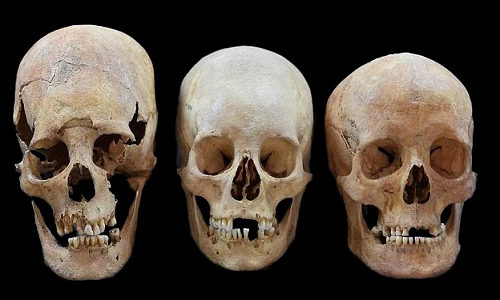 Vì sao phụ nữ Trung cổ có hộp sọ giống người ngoài hành tinh?