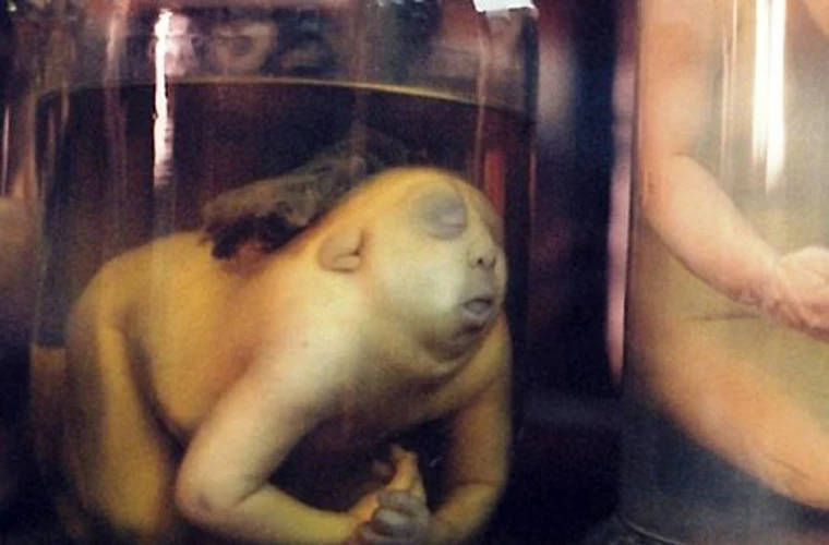 Bên trong bảo tàng rùng rợn nhất thế giới