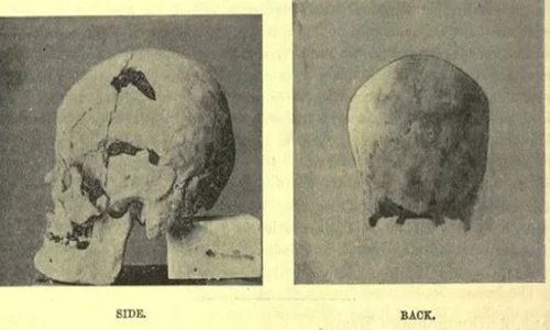 Pharaoh Ai Cập là “người khổng lồ” đầu tiên trong lịch sử?
