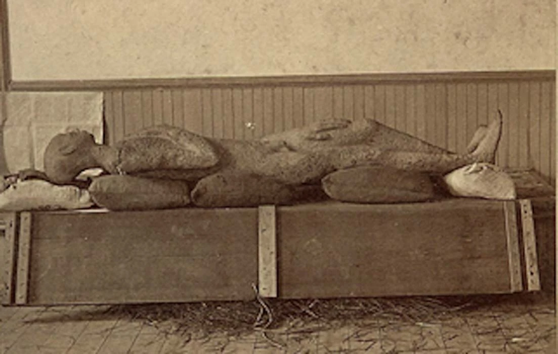 Rùng mình bằng chứng khó cãi về hiện tượng "người hóa đá"