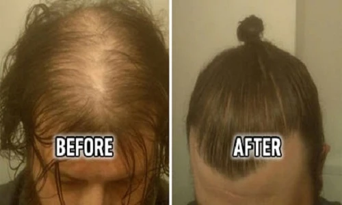 Sự thật đắng lòng sau mái tóc dài lãng tử của trai đẹp