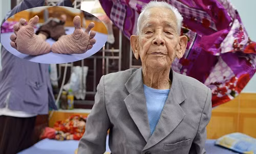 Ảnh: Cụ ông 104 tuổi ở Bắc Ninh có bàn chân kỳ lạ